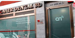 Escáner Dental 3D Centro Nemo Las Palmas - Fachada